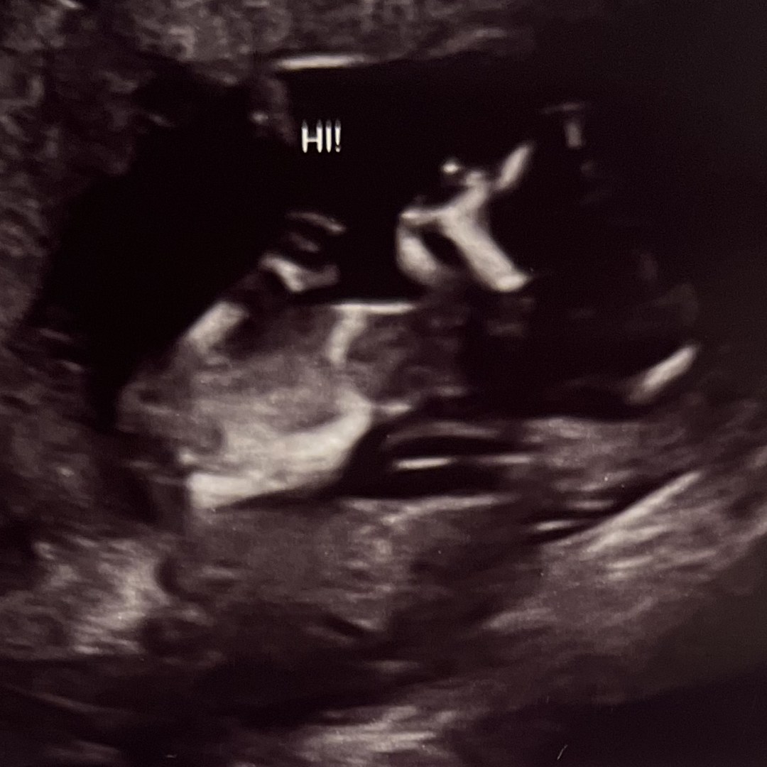 Photo shared by Yineilia for their Babylist baby registry.