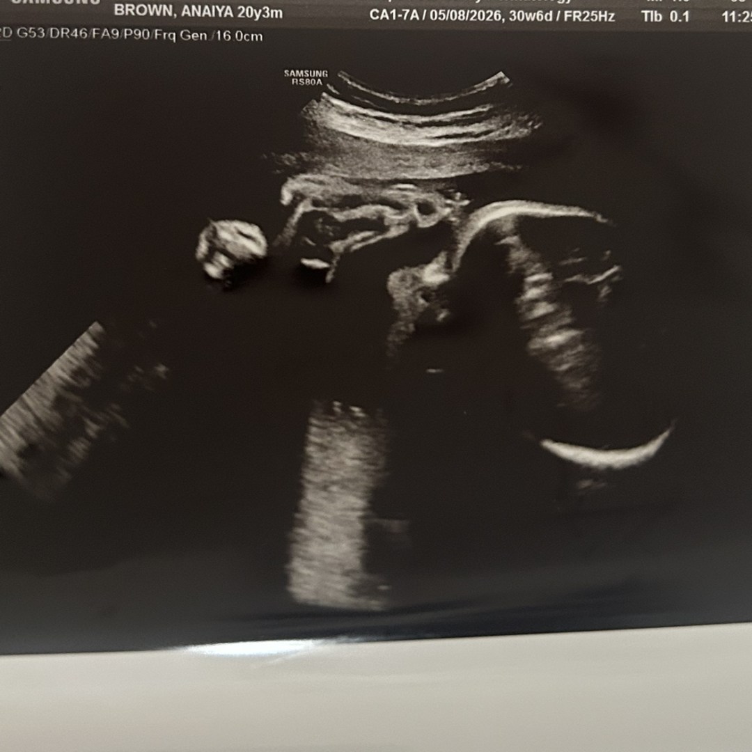 Photo shared by Anaiya for their Babylist baby registry.