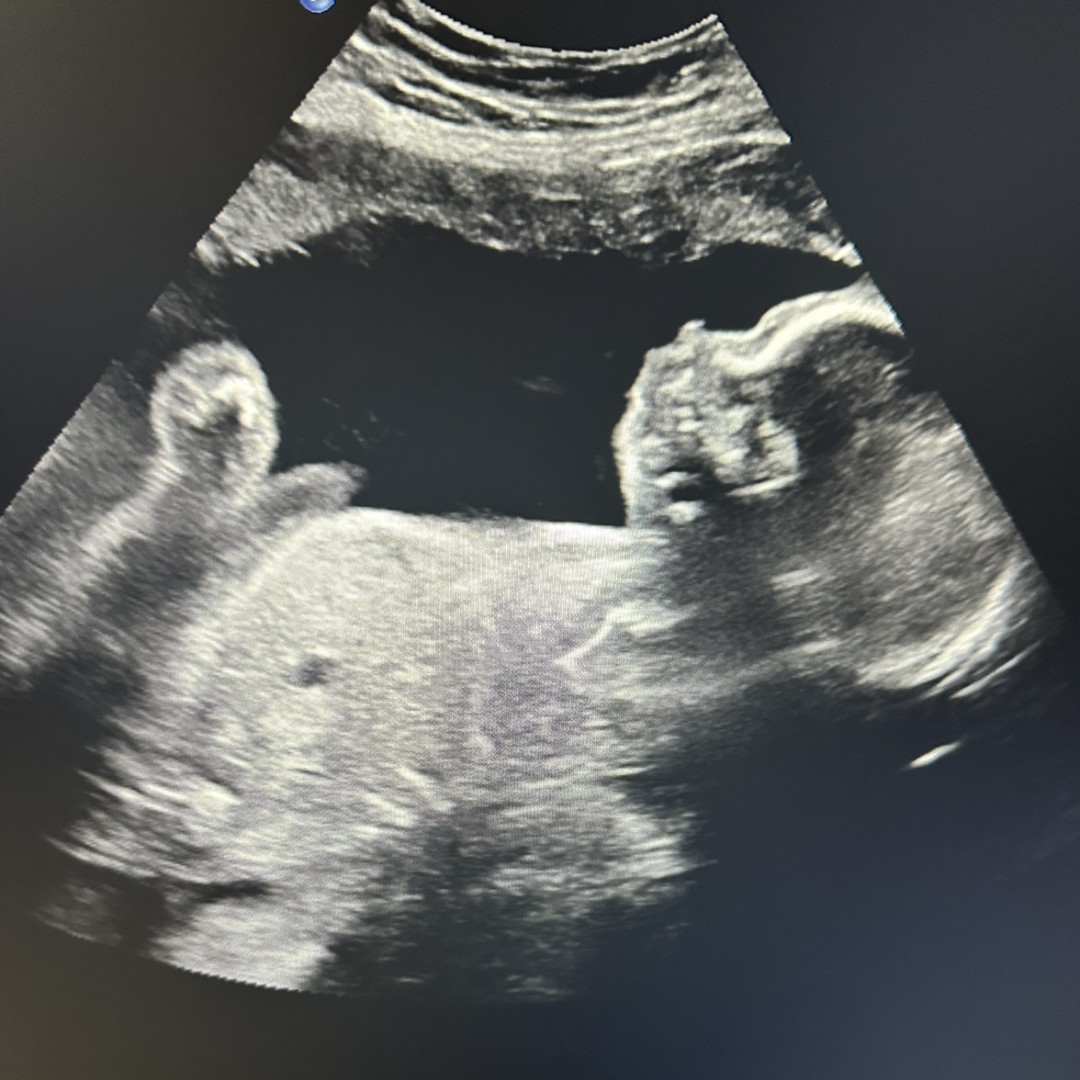 Photo shared by Shelby for their Babylist baby registry.