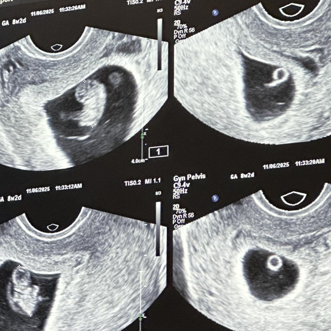 Photo shared by Jaycee for their Babylist baby registry.