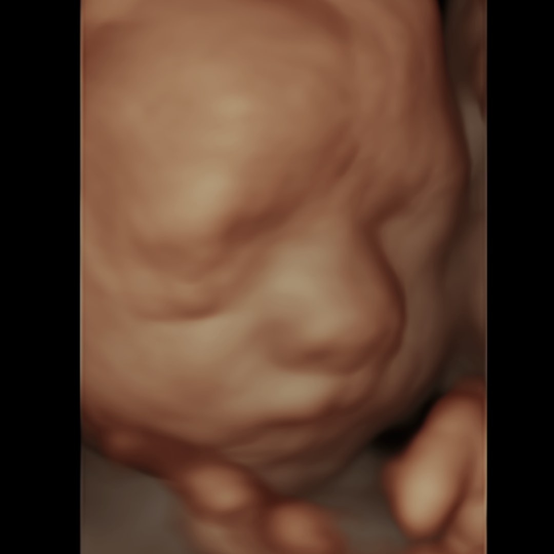 Photo shared by Teresa for their Babylist baby registry.