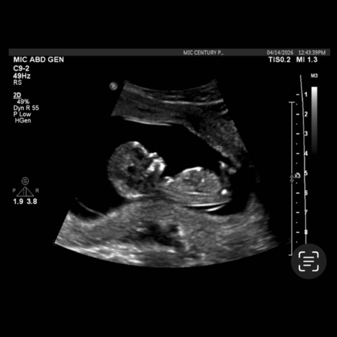 Photo shared by Alex for their Babylist baby registry.
