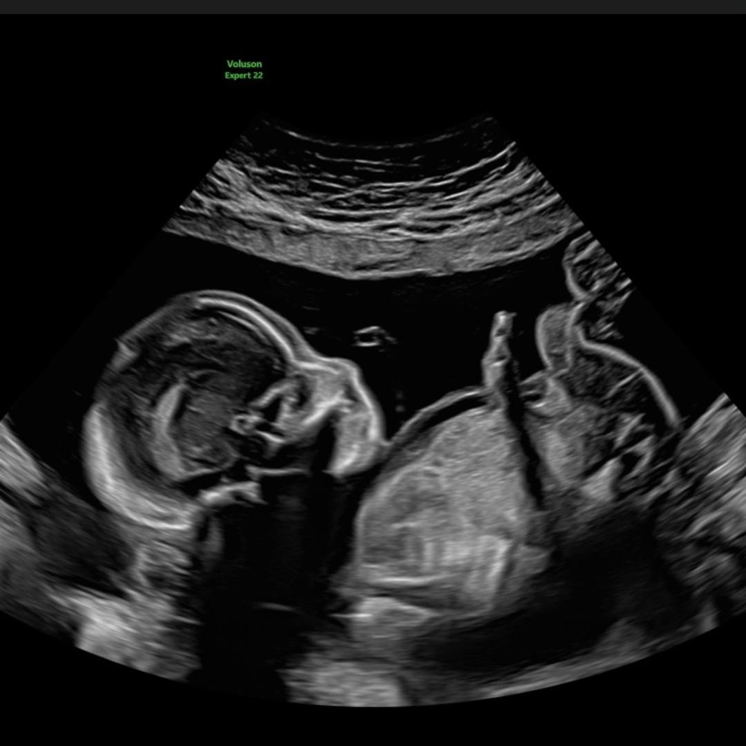 Photo shared by Elaine for their Babylist baby registry.