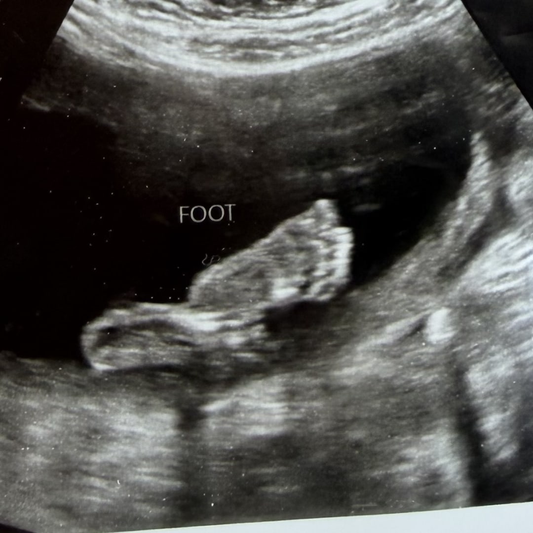 Photo shared by Harvey for their Babylist baby registry.