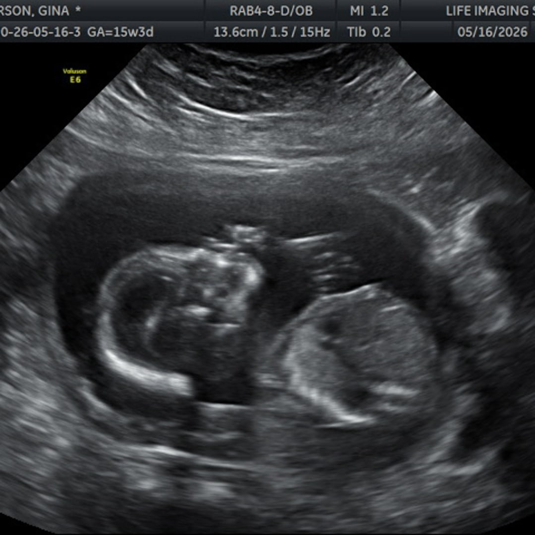 Photo shared by Ginamarie & Julien for their Babylist baby registry.
