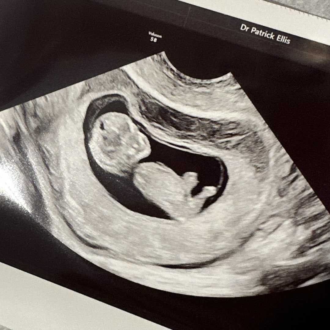 Photo shared by Anahi for their Babylist baby registry.