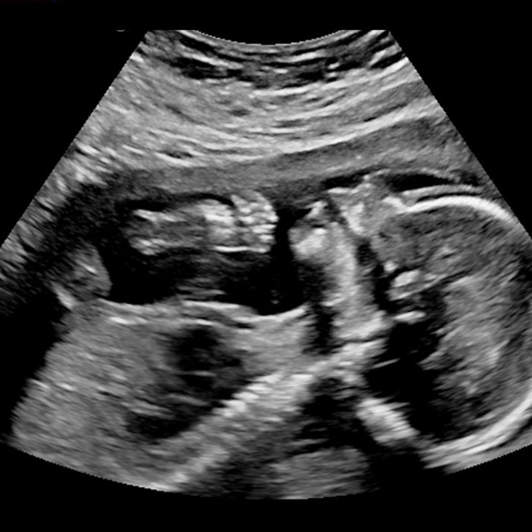 Photo shared by Dinita for their Babylist baby registry.