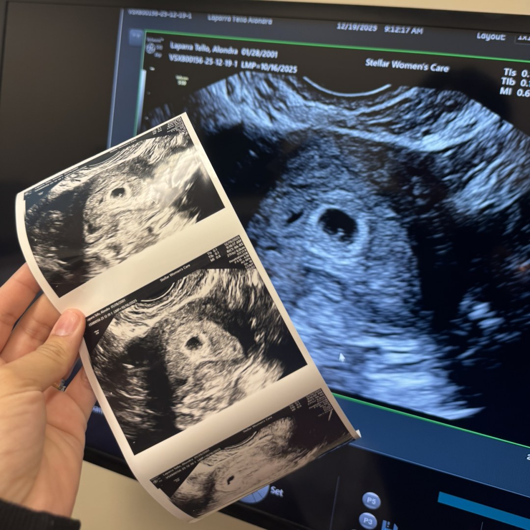 Photo shared by Alondra for their Babylist baby registry.