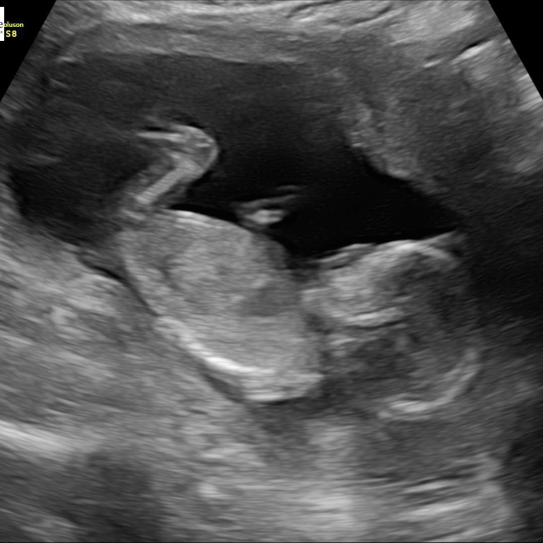 Photo shared by Courtney for their Babylist baby registry.