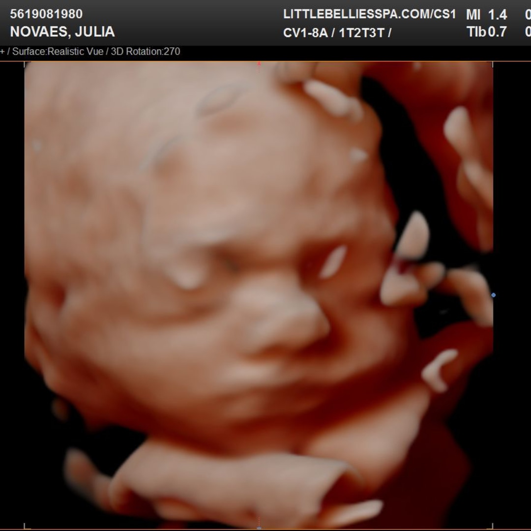 Photo shared by Julia for their Babylist baby registry.