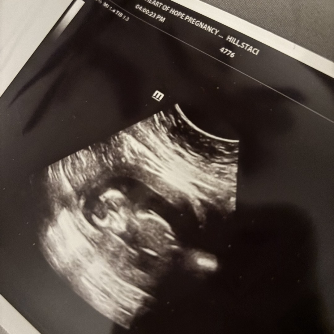 Photo shared by Staci for their Babylist baby registry.