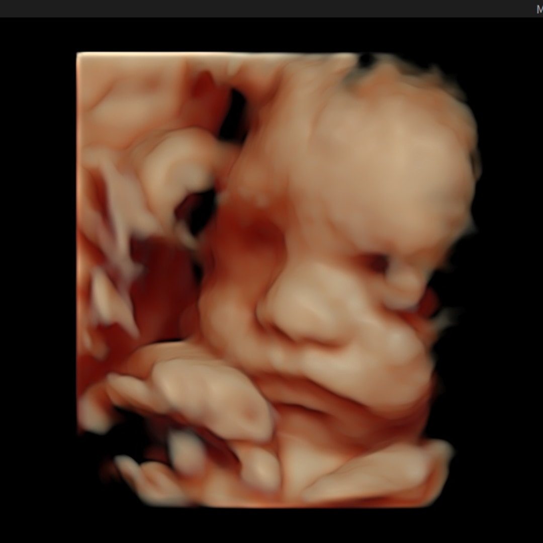 Photo shared by Maggie for their Babylist baby registry.