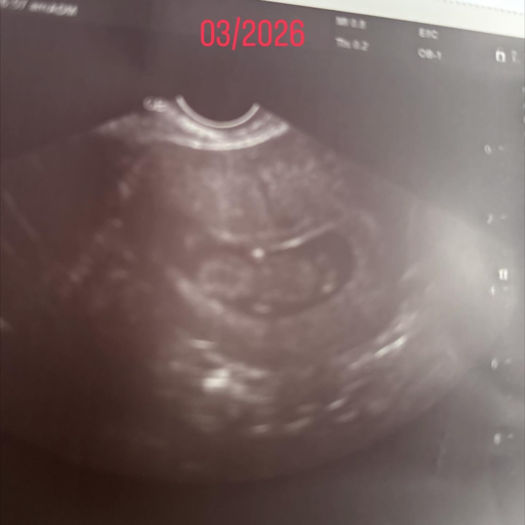 Photo shared by Arlene for their Babylist baby registry.