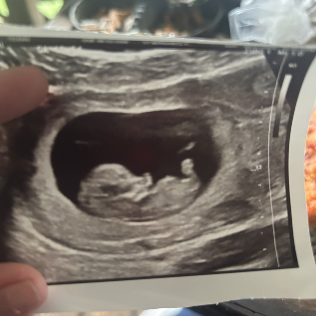 Photo shared by Hollie for their Babylist baby registry.