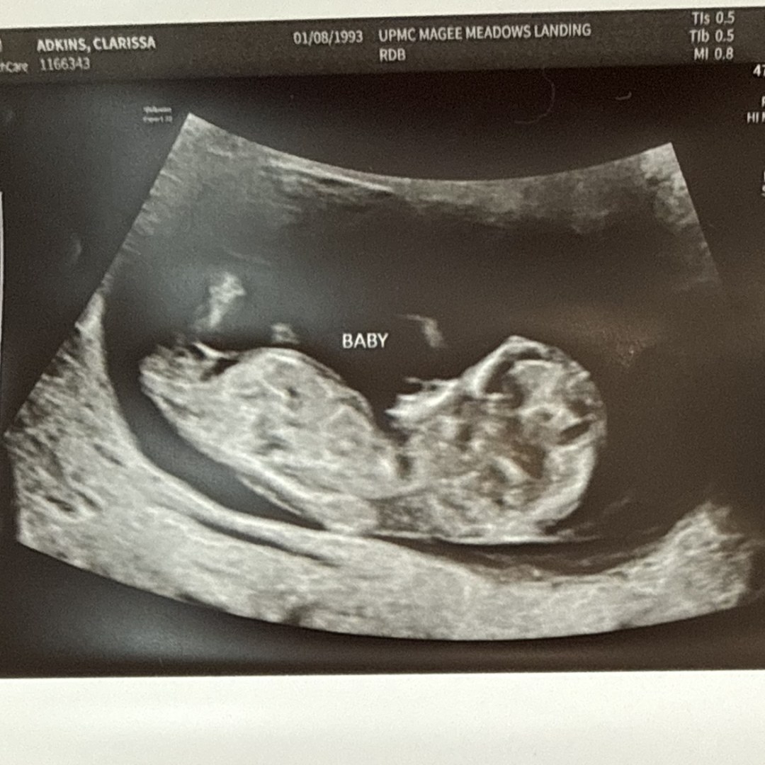 Photo shared by Clarissa for their Babylist baby registry.