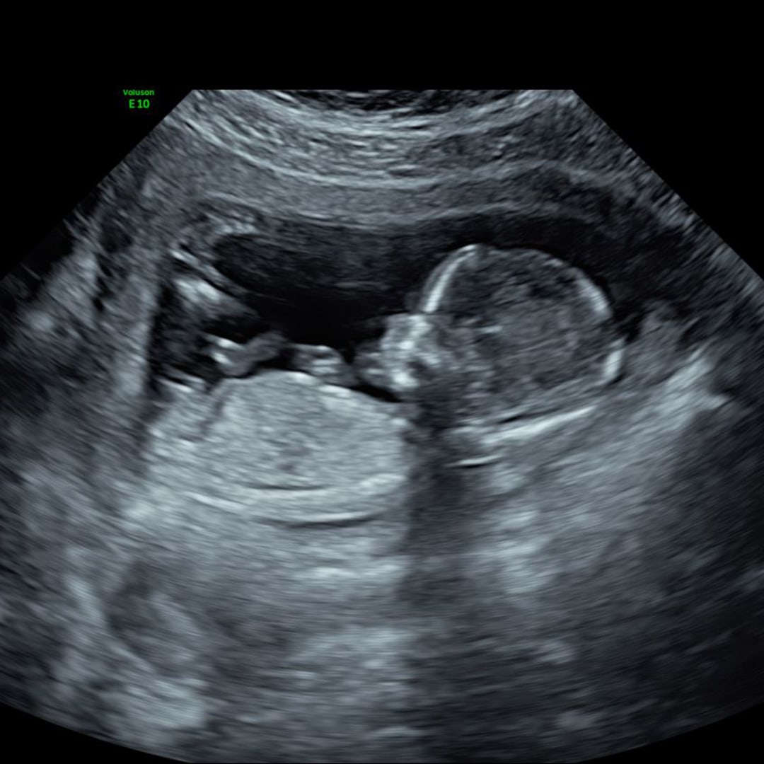 Photo shared by Deidre for their Babylist baby registry.