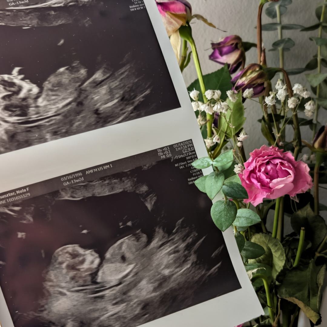 Photo shared by Nola for their Babylist baby registry.