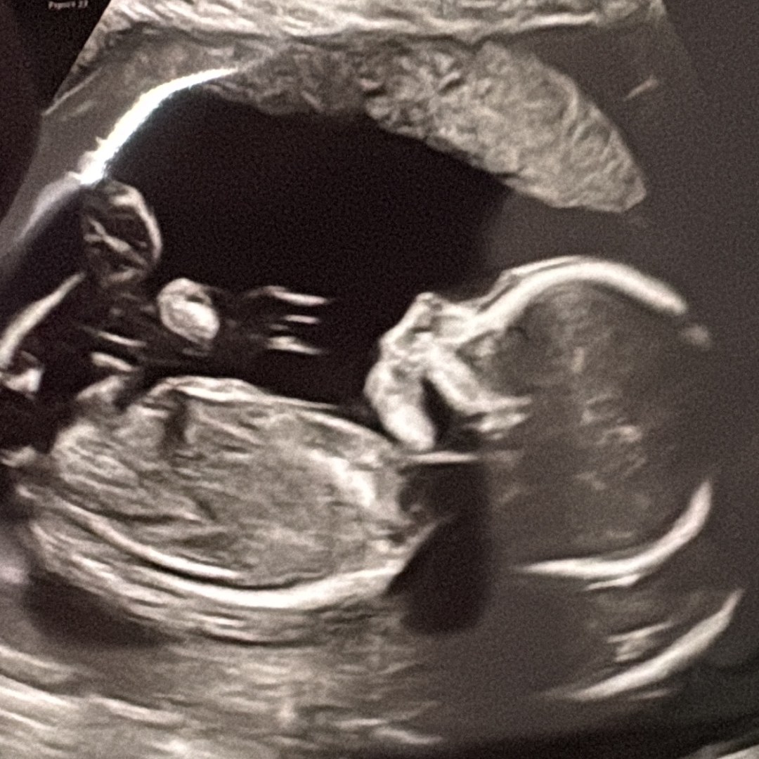 Photo shared by Arielle for their Babylist baby registry.