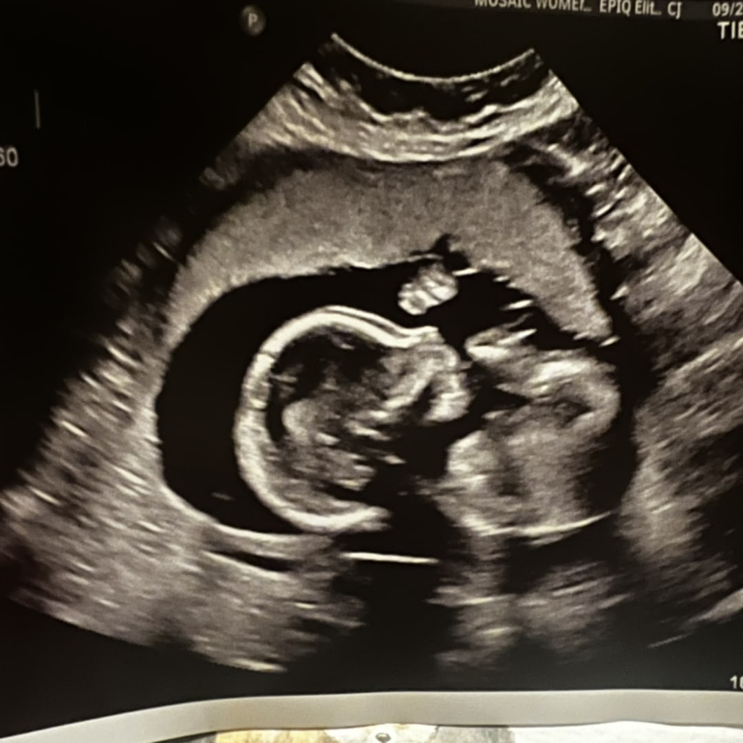 Photo shared by Stephanie for their Babylist baby registry.