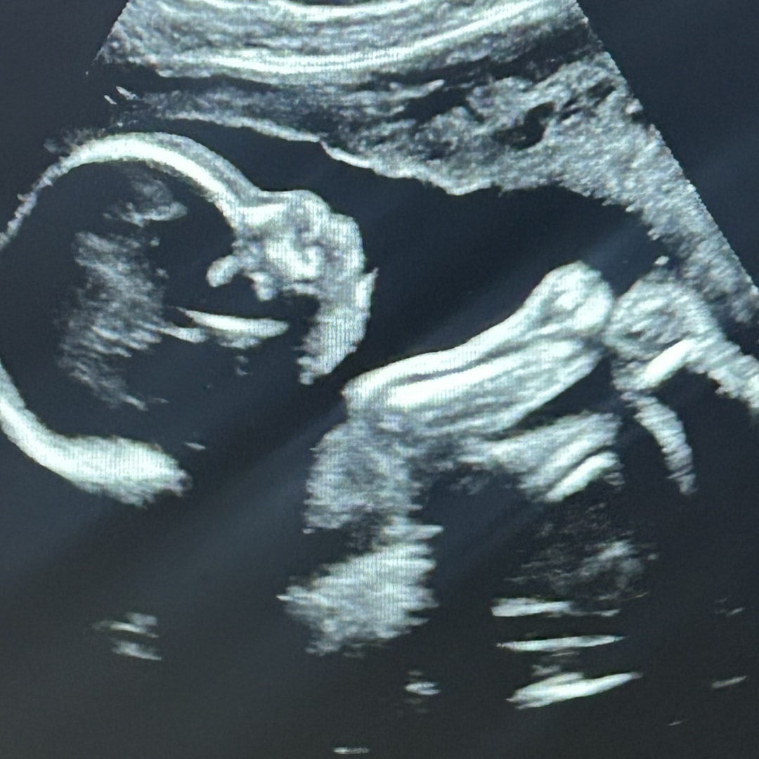 Photo shared by Raymani for their Babylist baby registry.