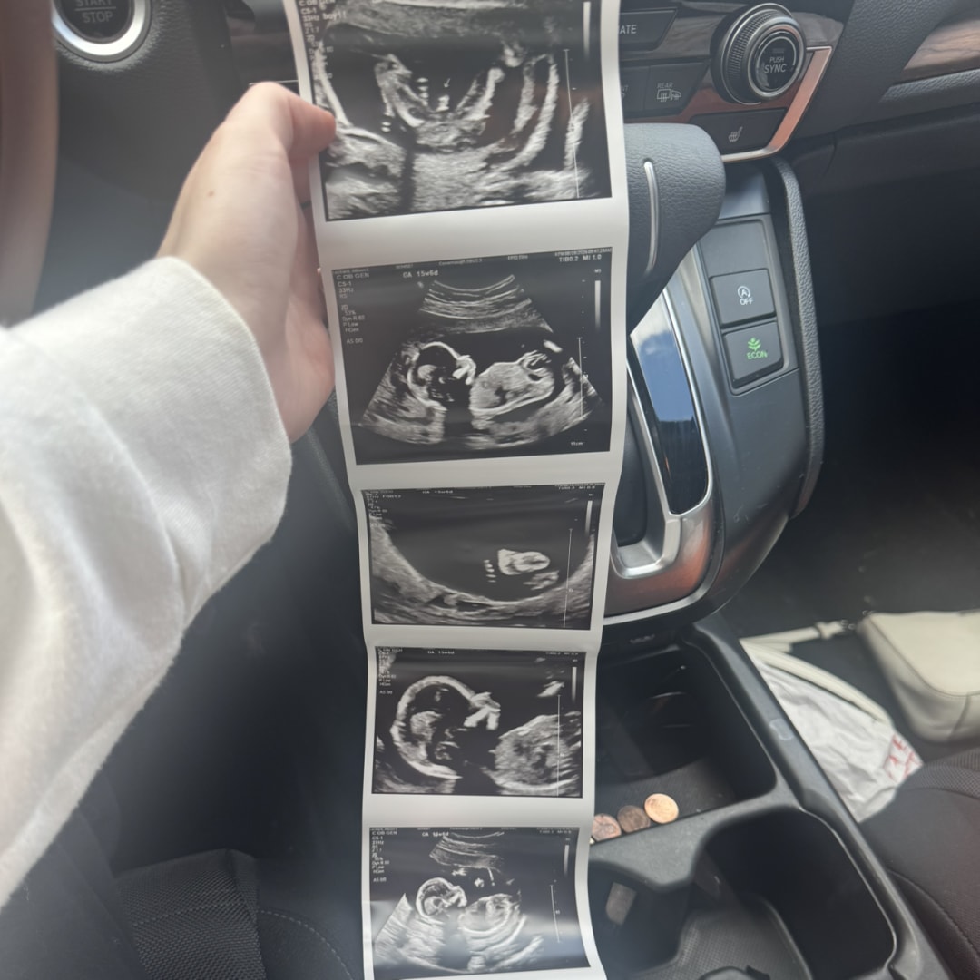 Photo shared by Allison for their Babylist baby registry.