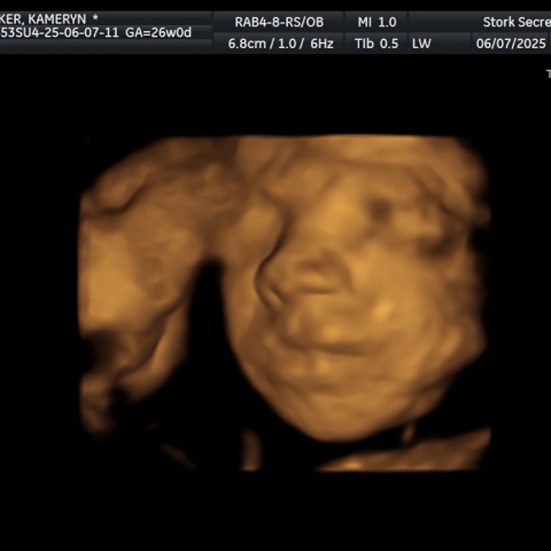 Photo shared by Kameryn for their Babylist baby registry.