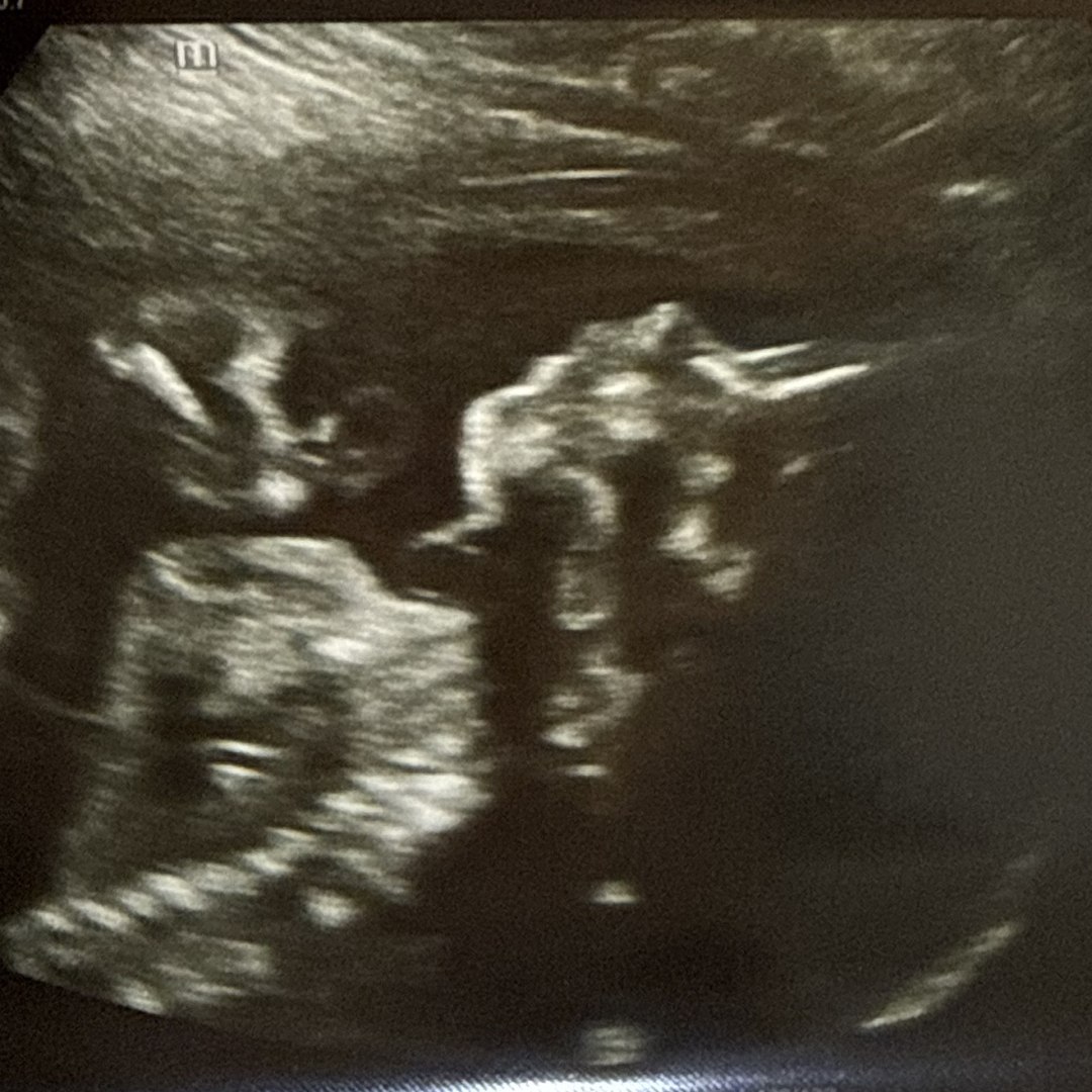 Photo shared by Ellie for their Babylist baby registry.