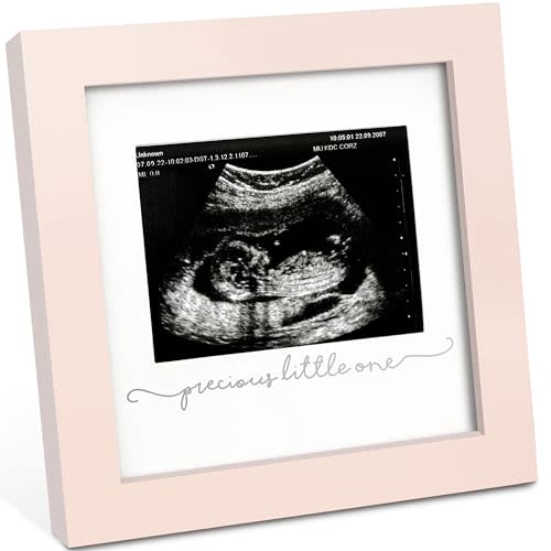 KeaBabies Baby Sonogram Picture Frame - Modern Ultrasound Picture Frames for Mom to Be, First Pregnancy Gifts for Expecting Mom & First Time Dad, Baby Gender Reveal & Mother's Day(Petal Pink)