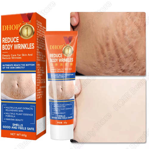 Lyla Skin Stretch Marks Permanent Removal Cream Maternity Pregnant Women Pregnancy Anti-Winkle Smooth Repair Firming Skin Body Skin Care - Stretch Marks Permanent Removal Cream Maternity Pregnant Women Pregnancy Anti-Winkle Smooth Repair Firming Skin Body