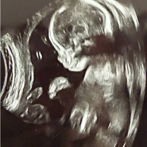 Maternity Leave Fund
