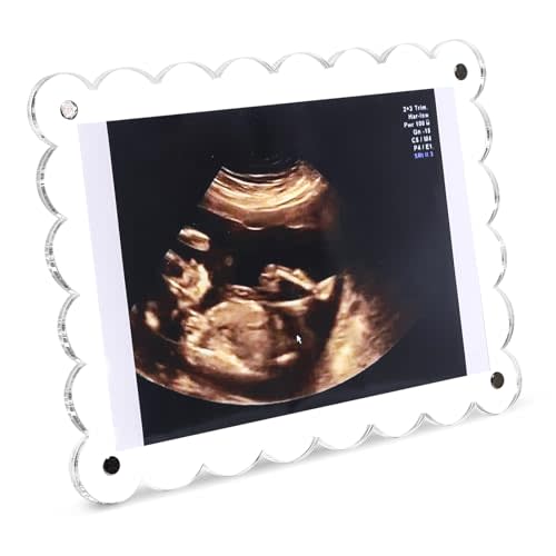 Mlatnod Magnetic Clear Acrylic Scalloped Baby Ultrasound Picture Frame - Sonogram Frame for Refrigerator, Display for Pregnancy Announcement, Gender Reveal & Expecting Parents Gifts(No Stand)