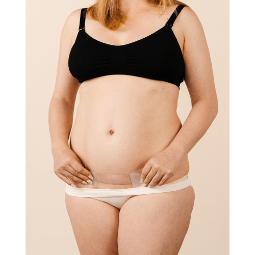 C-Section Silicone Scar Strips