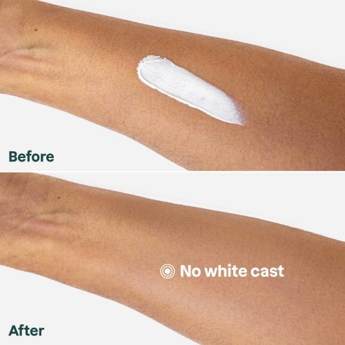 Kids Mineral Sunscreen for Sensitive Skin