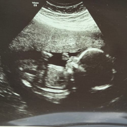 Baby Fund • Fondos para el Bebé