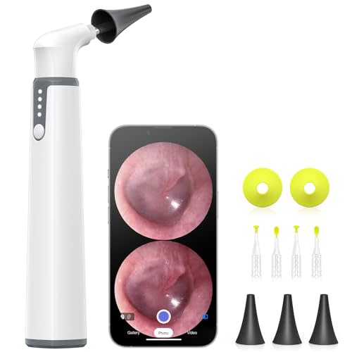 Wireless Otoscope with Gyroscope, Ear Camera with Dual View, 3.9 mm Otoscope with Light, Ear Scope with Ear Wax Removal Tool for Kids, Adults, and Pets, Compatible with iPhone and Android