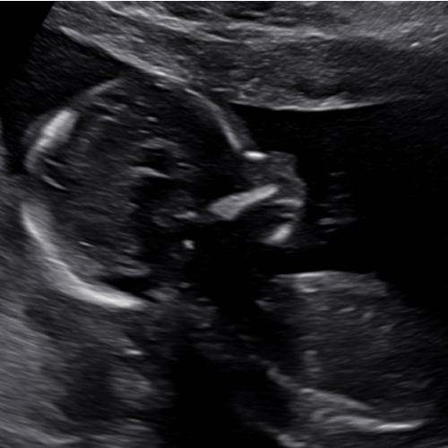 Baby’s First Year