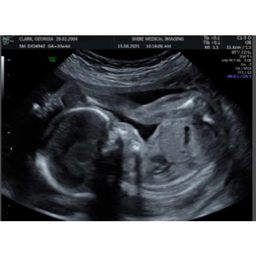 Big items and nursery setup baby fund