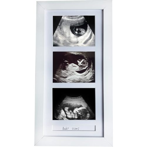 Triple Ultrasound Picture Frames, Sonogram Picture Frame 3 Photos,Pregnancy Announcements,Pregnancy Gifts for First Time Moms,First Time Mom Gift,White,Ultrasound Photo Album
