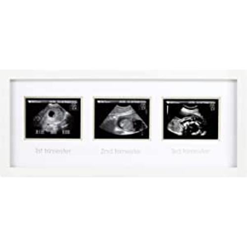 Pearhead Triple Sonogram Pregnancy Frame, Watch Baby Grow Through All Three Trimesters, Ultrasound Progression Frame, White - Trimester Frame, White