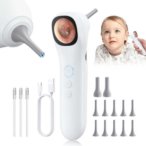 Smart Otoscope Ear Camera with 1.38'' Screen, 1080P Ear Scope with 4 LEDs, 12 Silicone Specula Tips, Support Photo and Video, PC View, Ideal Pocket Otoscope for Adults, Kids and Pets