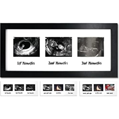 IHEIPYE Triple Sonogram Pregnancy Frame – Baby Ultrasound Picture Frame with Story for Expecting Parents, Baby Shower Frame, Baby Grow Through All Three Trimesters Frame, Nursery Decor, Black