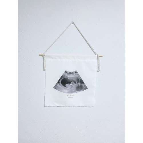 Custom ultrasound image banner, sonogram sign, baby shower gift, ultrasound image sign, sonogram banner, mother's day gift, ultrasound sign