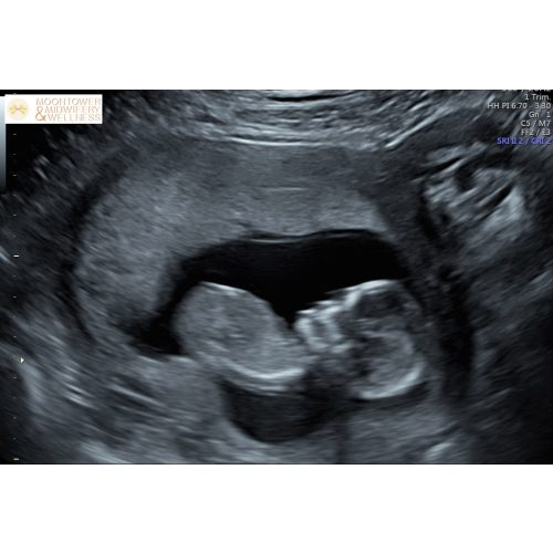 Baby Young Fund