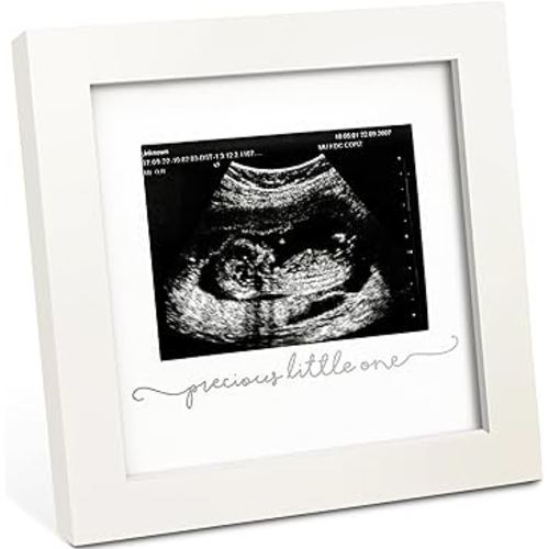 KeaBabies Baby Sonogram Picture Frame - Modern Ultrasound Picture Frames for Mom to Be, First Pregnancy Gifts for Expecting Mom & First Time Dad, Baby Gender Reveal Gifts (Alpine White)