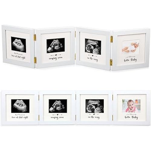 Beeveer Sonogram Picture Frame Quadruple Ultrasound Picture Frame 4 Folding Pregnancy Keepsake Photo for Pregnancy Announcements First Time to Be Dad Mom Gifts Gender Nursery Baby Gift(White)