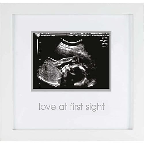 Pearhead Love at First Sight Sonogram Picture Frame, Gender Neutral Ultrasound Keepsake, Ideal Pregnancy Gift, Baby Shower and Nursery Decor, 4”x3” Photo Insert, White