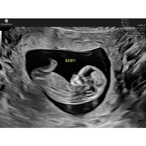 Babylist Parental Leave Fund