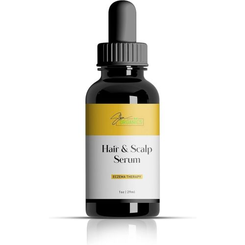 Shea Organics Soothing Scalp Oil – 1 OZ | Relief for Dry, Itchy Scalp, Dandruff & Cradle Cap | Gentle Moisturizer for Baby Eczema & Sensitive Skin | Oat Oil, Vitamin E, Honey & Tea Tree