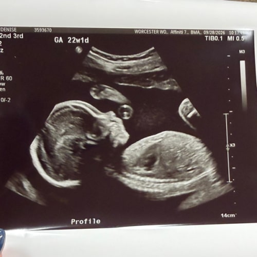 Babylist Cash Fund