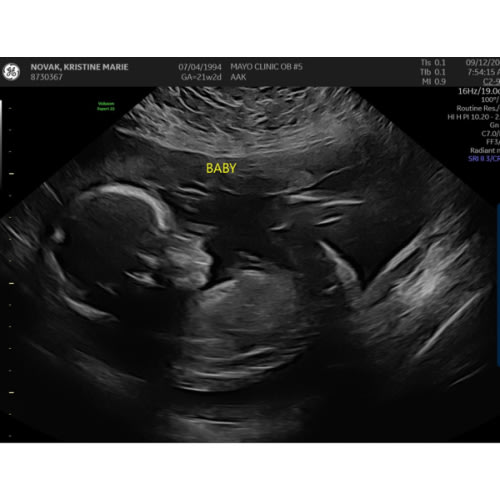 Baby Boy Kuchinka Cash Fund